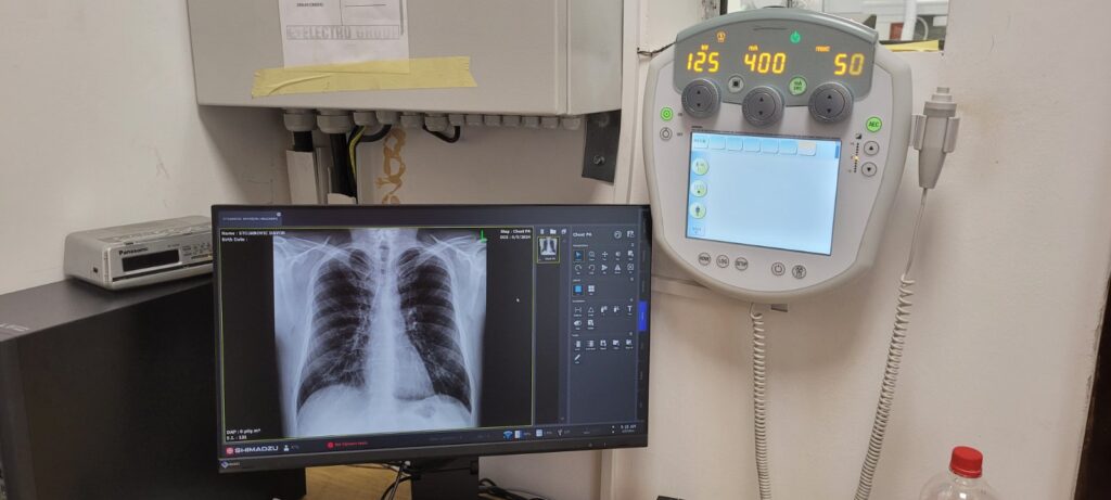 Dom zdravlja Tivat nabavio novi digitalni RTG aparat